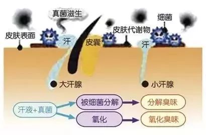 最新腋臭治疗方法,引领潮流的腋臭攻克新方案。