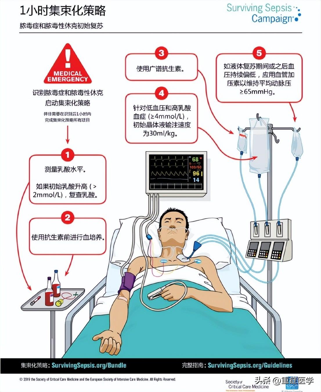 脓毒性休克最新指南,脓毒症休克诊疗新标准